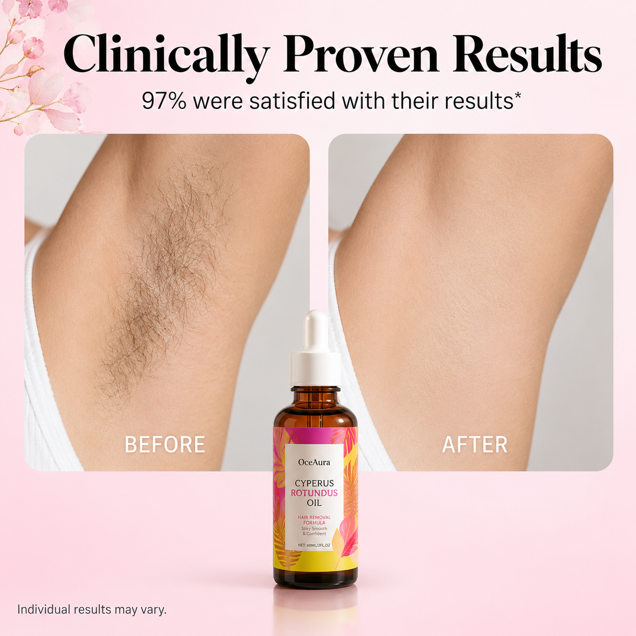 Cyperus Rotundus Hair Care Oil